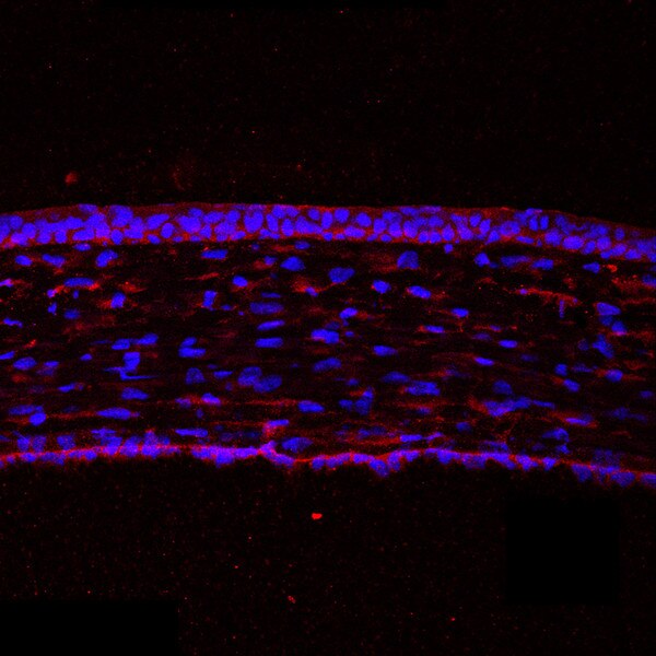IF of a mouse cornea labeled with DSHB antibody AFFN-KDM6B-7E10 against Lysine(K)-specific demethylase 6B (red). Image credit: Lachke Lab, University of Delaware.